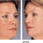 What Is Lycogel Makeup?