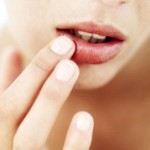 chapped-lips-treatment-cure-remedy