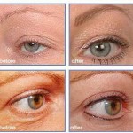 Permanent Makeup Micropigmentation